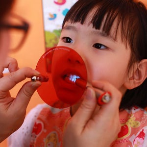 비츠케어 셀프 치석제거기 입냄새 충치 구강 예방 치아관리 용품 양치질검사 치카체커