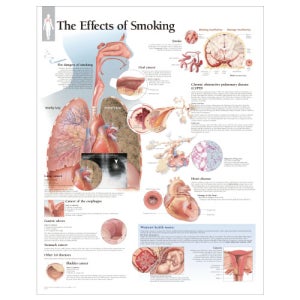 흡연의 영향들 평면코팅 인체해부도 -1352 ( The Effects of Smoking )