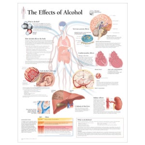 알콜의 영향들 평면코팅 인체해부도 -1653 ( The Effects of Alcohol )