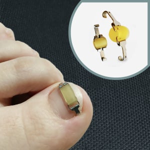 라이언문 내성발톱 교정기 케어 세트 관리도구 교정팁 와이어 밴드 (저렴한 3+1개입)