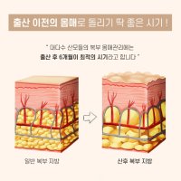 제왕절개 산후복대 와이프 아내임신선물 순면 산전 출산후복대