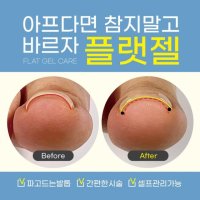 바르면 펴지는 크랄레젤 플랫젤 발톱젤