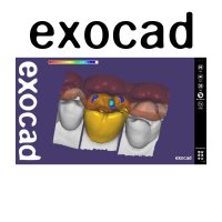 엑소캐드 임플란트모듈 단품 exocad Dental CAD