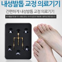 내성발톱 교정기 치료 교정 내향성발톱 치료기