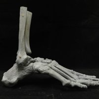 발목뼈 sawbone, 발뼈 sawbone, ankle jiont 모형