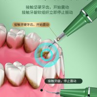 초음파 셀프스케일링 전동 치태 가시 초음파 치석제거기 세척 구취