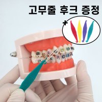 치아 교정 교정기 고무줄 1팩