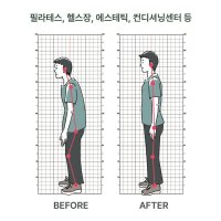 체형분석표 스크린 체형측정 블라인드 격자 자세교정 평가 헬스장 필라테스 한의원