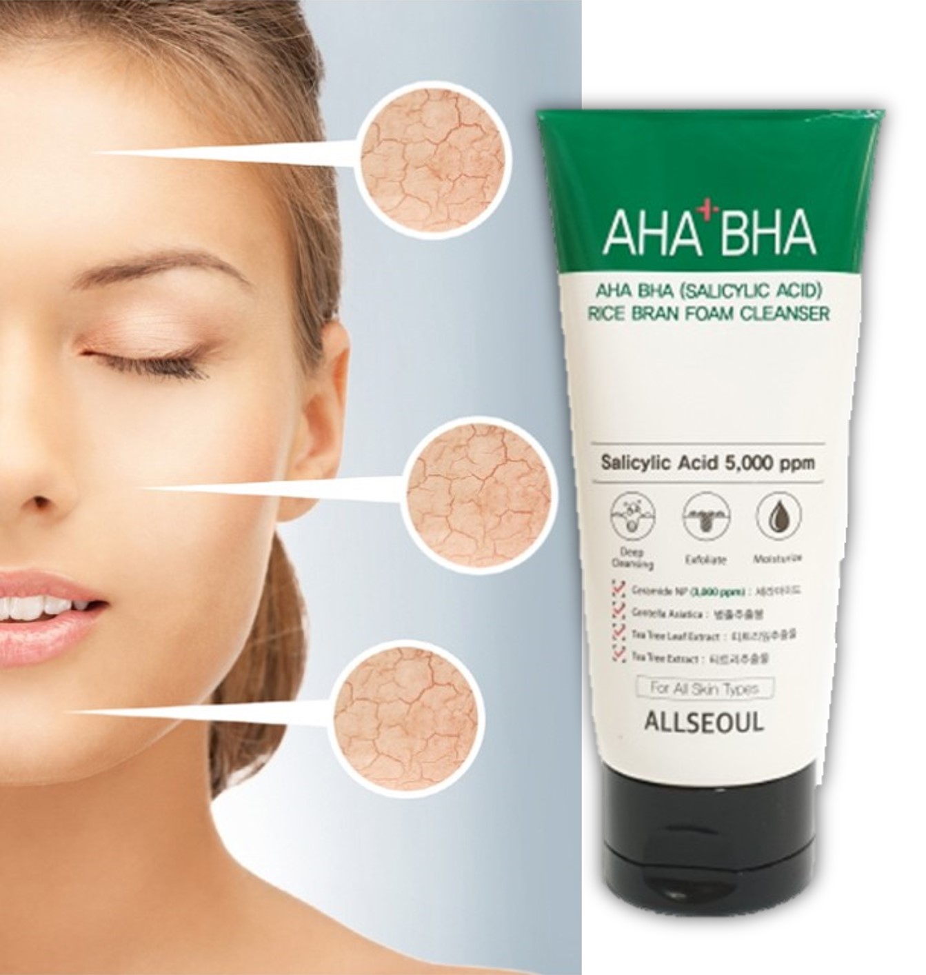 민감성바하클렌징폼 좁쌀<b>여드름</b> 트러블 지성 폼클렌징 수부지 세안제 모공축소 페이스워시