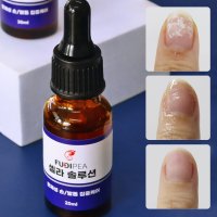 푸디페아 셀라 솔루션 20ml 문제성 손발톱