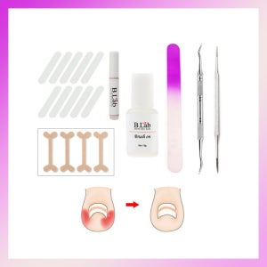 내성발톱 치료 교정기 내향성 교정 파고드는