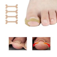내성발톱치료' 최저가 검색, 최저가 3,800원 : 쿠차 | 시간을 줄여주는 쇼핑검색 내성발톱치료' 최저가 검색, 최저가 3,800원 : 쿠차 | 시간을 줄여주는 쇼핑검색