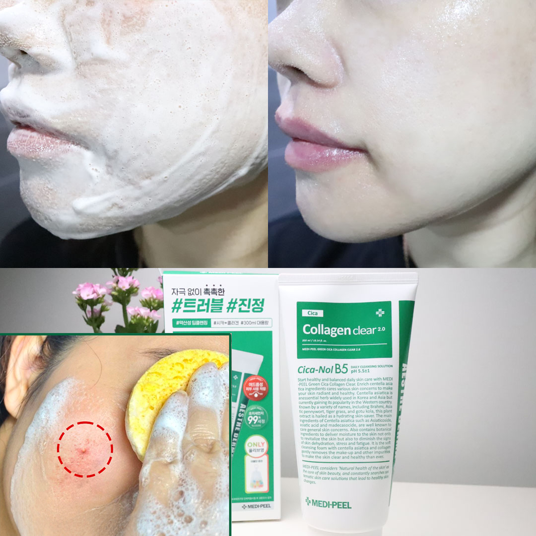 대용량 좁쌀 <b>여드름</b> <b>올리브</b>영 약산성 클렌징폼 클렌저 판테놀 청소년 살리실산 폼클렌징 시카