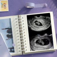 초음파 앨범 센스있는 임신 산모 선물 아기 성장 다이어리