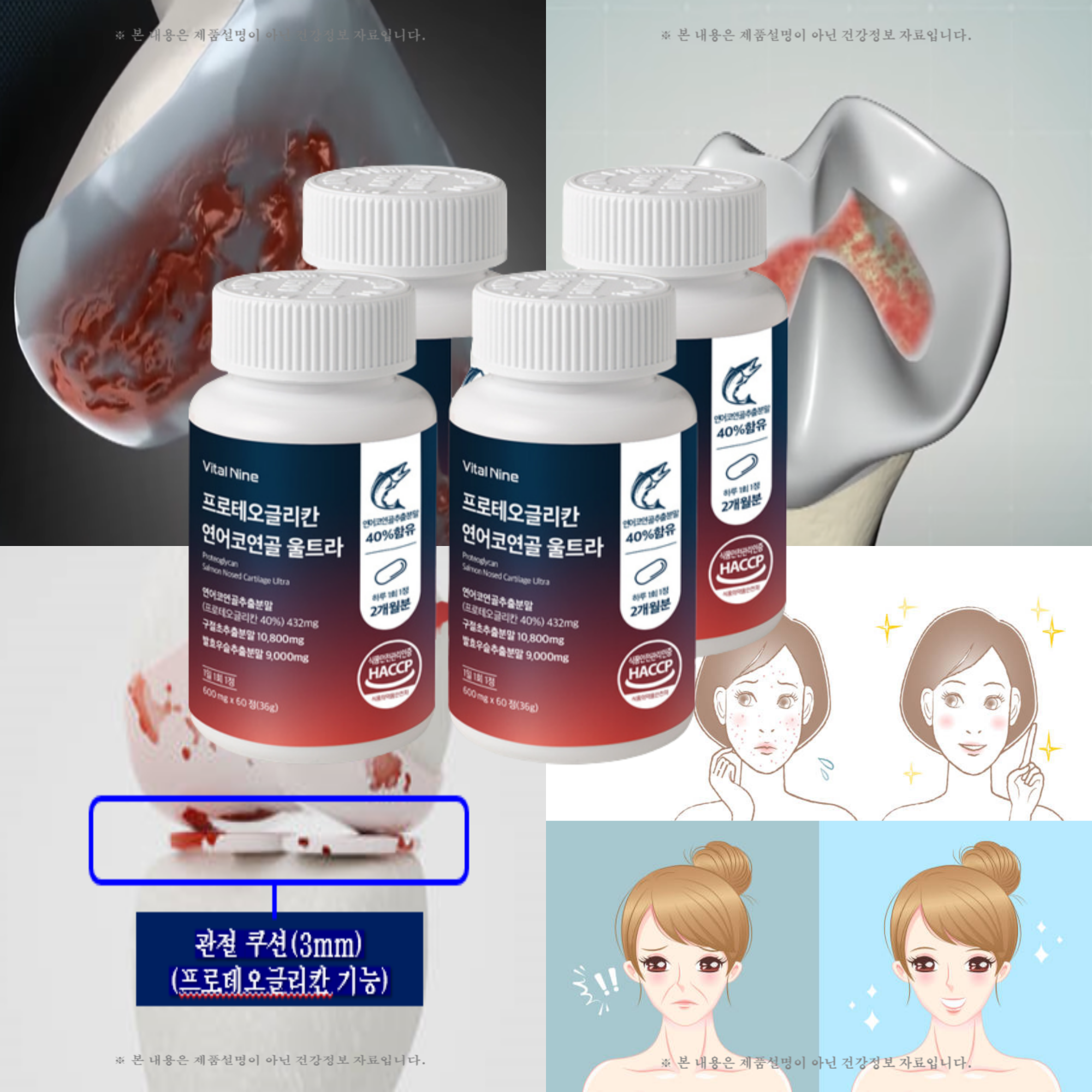 프로테오글리칸 울트라 연골 피부 영양제 연어코연골 구절초 우슬 60정 4통