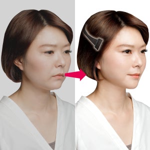 와사비네코 순간리프트업 리프팅클립 페이스 얼굴리프팅 팔자주름 즉석 땡기미 땡김이 얼굴 밴드