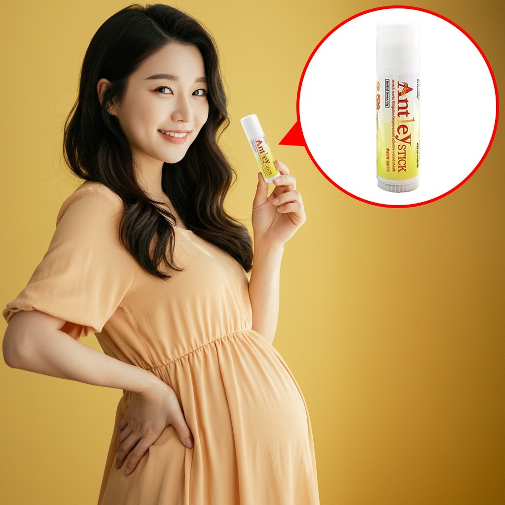 임산부 튼살크림 청소년 붉은 튼살연고 전용 <b>출산후</b> 제거 재생 안틀레이 스틱