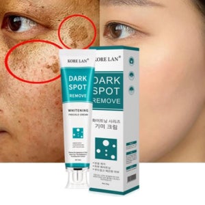 반점 제거 연고 기미 착색 검버섯 멜라토닝 멜라논 색소 침착 크림 연고