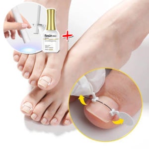 디젤 내성발톱 자가치료 코렉터 v2 단품