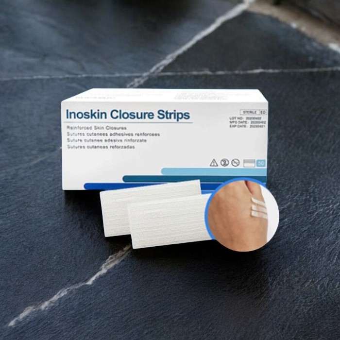 찢어진 상처 봉합 밴드 실밥 없는 응급 <b>처치</b> 밴드 6mmx75mm 10매