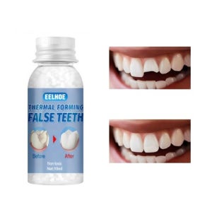 치아 의치 접착제 깨진이 홈 틈 메우기 임시 치아 만들기