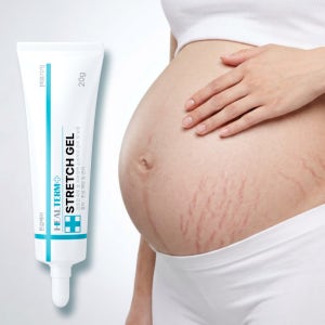[의료기기] 스트레치 마크 겔 20g 튼살 크림 연고 임산부 예비맘 사춘기