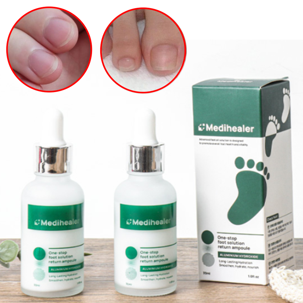 박대표마켓 손발톱영양제 30ml 문제성 <b>손톱</b> 발톱 네일세럼 보호제 갈라짐 손상관리