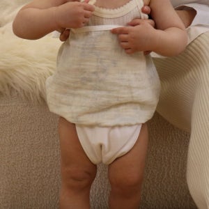 기저귀발진 해결, 통풍 치마, 천기저귀 아야야, 아기엉덩이발진