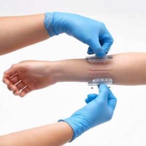 상처 봉합 밴드 키트 찢어진 얼굴 벌어진 피부 관리 응급 풀밴드 의료용 테이프 3종