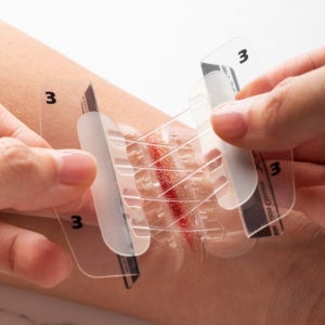 상처 봉합 밴드 키트 찢어진 얼굴 벌어진 피부 관리 응급 풀밴드 의료용 테이프