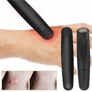 모기침 제거기 모기 물렸을때 간지럼 완화 버그 바이트띵 안티버그 벌침 제거 흡입기