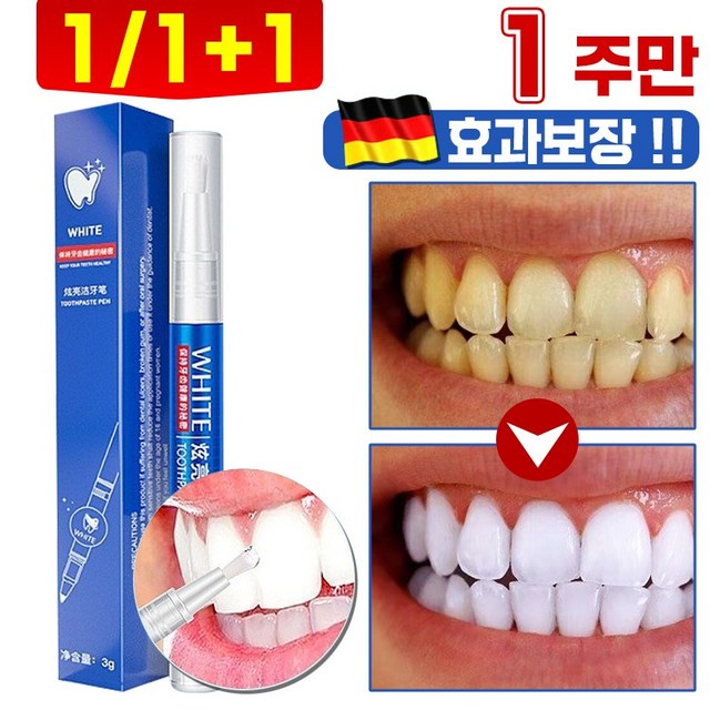 셀프 <b>불소</b>도포 <b>불소</b> 바니쉬 용액 도포제