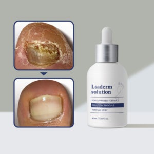 르사덤 발무조메 솔루션 발톱무좀균 문제성 발 냄새 약 20ml
