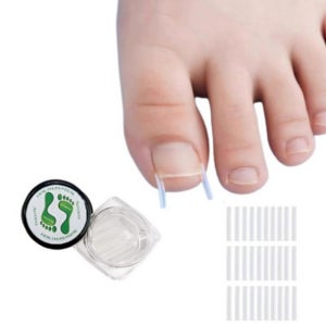 내성발톱 파고드는 내향성 며느리 발톱 파고듬 수술 자가치료 테이프 밴드 30매입