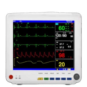 심전도 측정기 모니터 ECG 병동 혈액 산소 혈압 체크 심전도 측정기 (배터리없음)