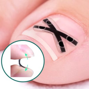 티탄토우 X자형 내성발톱 교정밴드 의료기기