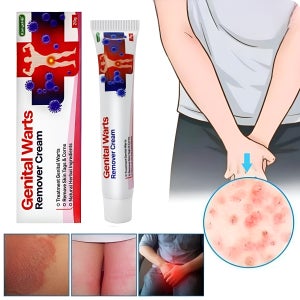 곤지름 연고 남자 생식기 사마귀 치료 콘딜로마 매독 헤르페스 제거 치료제 20g