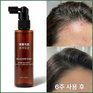 동의모감 창포 두피토닉 한방 두피뾰루지 케어